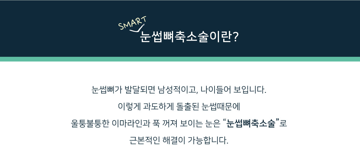 눈썹뼈출소술