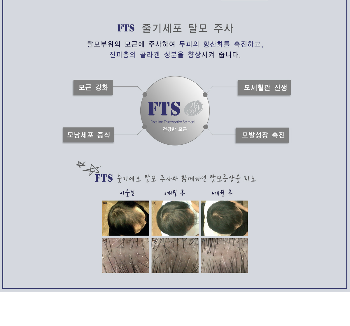 F.T.S.(줄기세포)