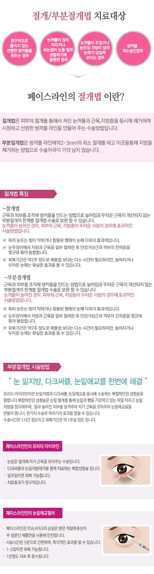 페이스라인 절개/부분절개법