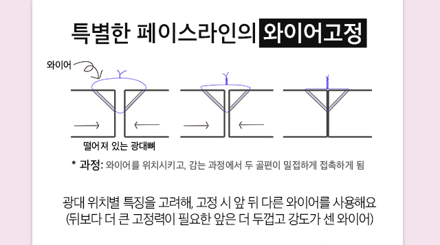 페이스라인 성형외과의원 안면윤곽 오해와 편견 