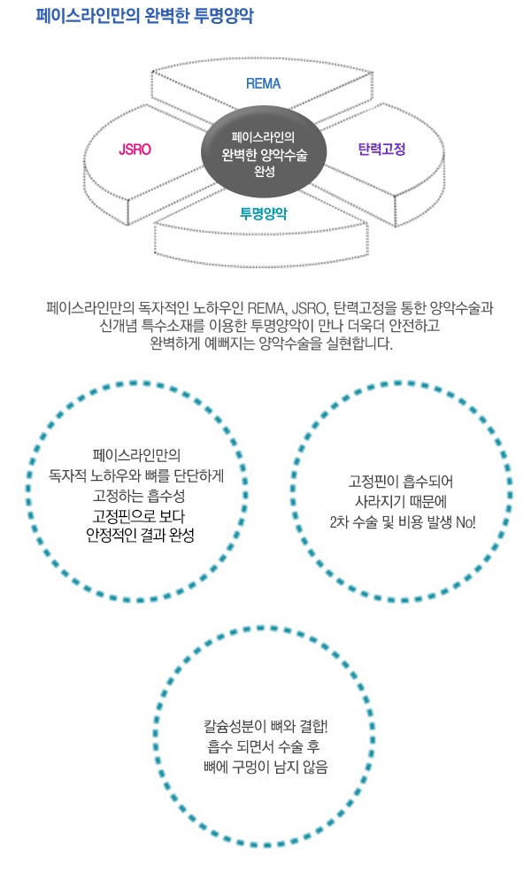 투명양악수술 (1).jpg