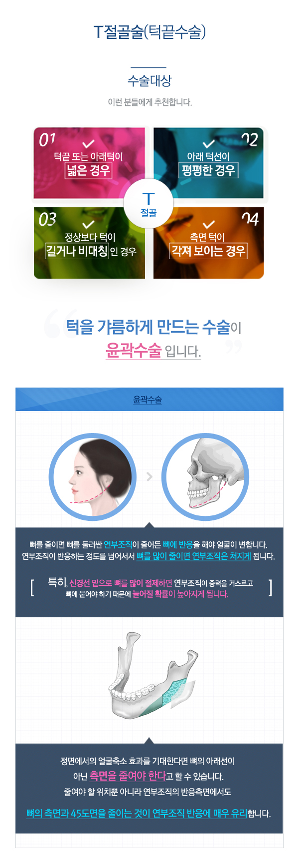 페이스라인 T절골술