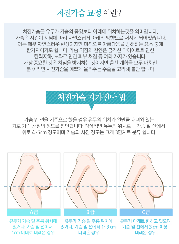 페이스라인 처진가슴교정