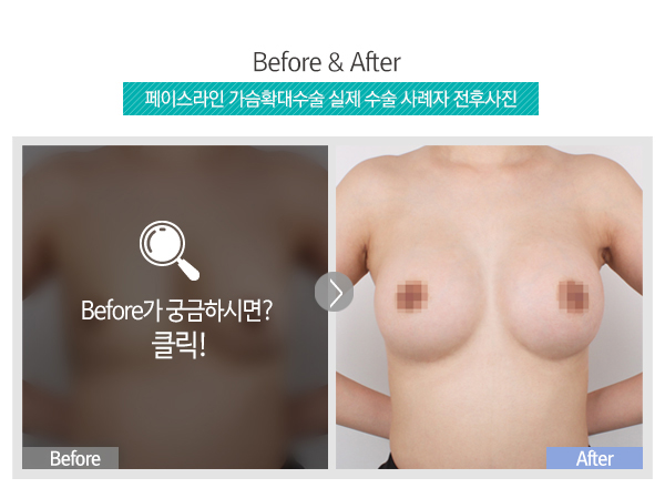 Before가 궁금하시면?클릭!