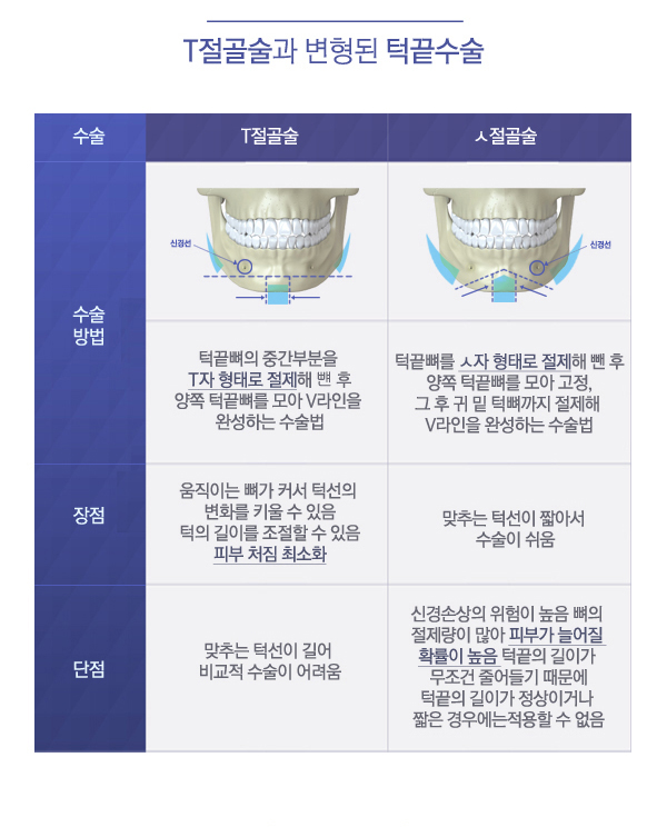 페이스라인 T절골술