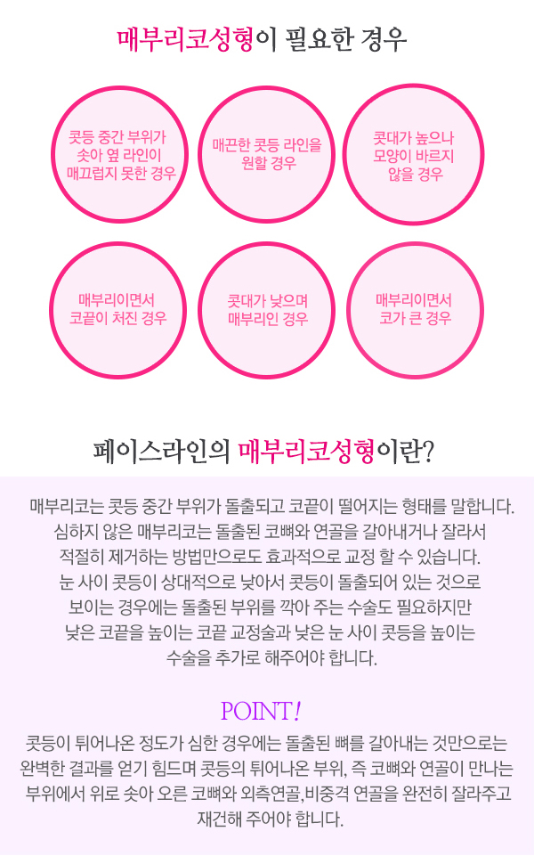 페이스라인 매부리코성형