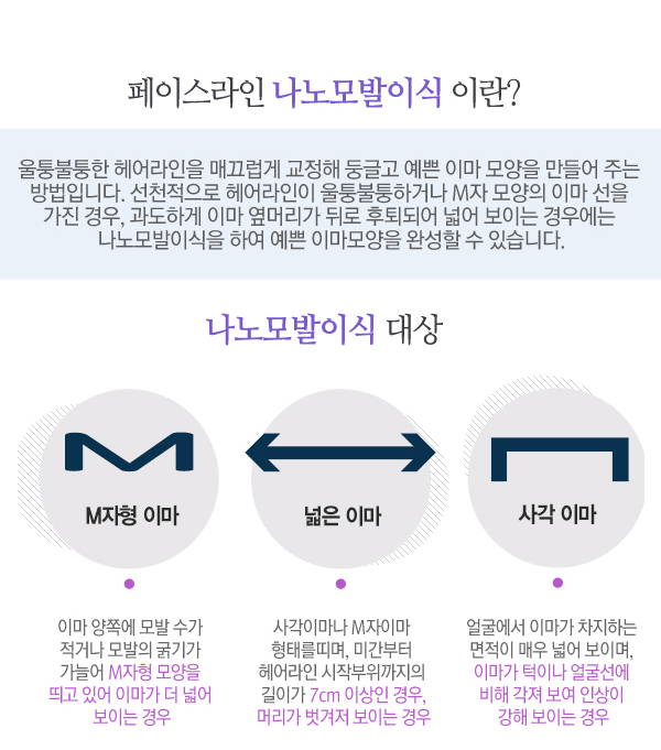 페이스라인 나노모발이식