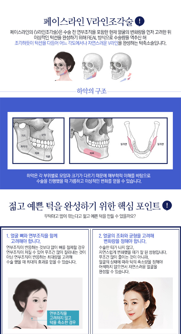 페이스라인 V라인조각술