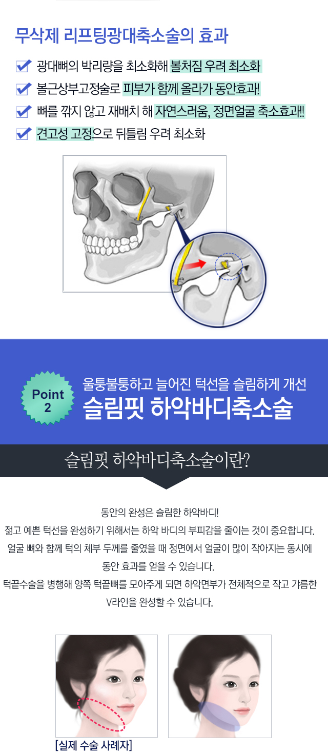 페이스라인 동안윤곽술