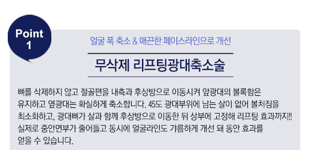 페이스라인 안티에이징동안윤곽술