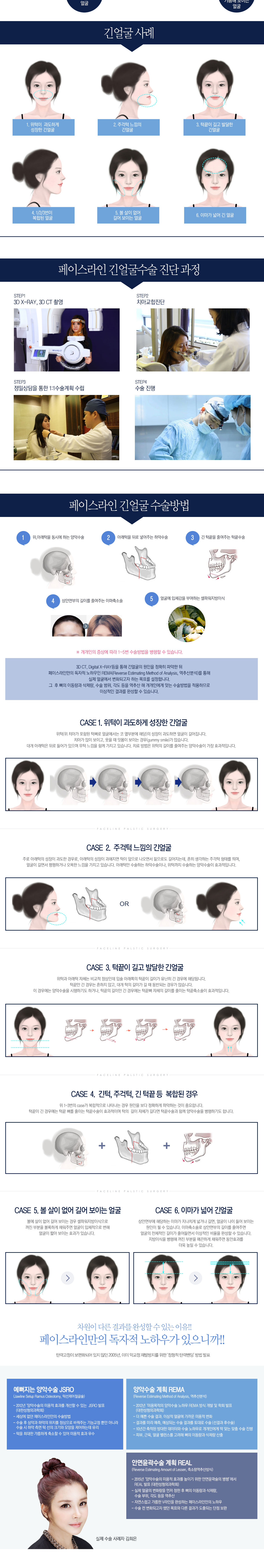 긴얼굴-3.jpg