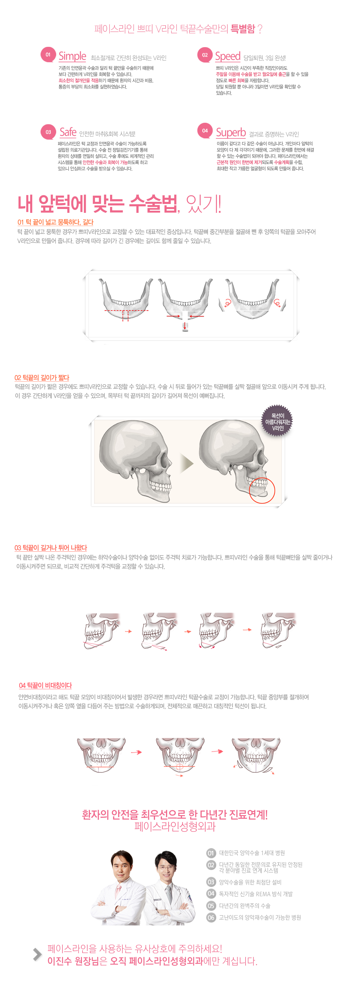 쁘띠v라인-2.jpg