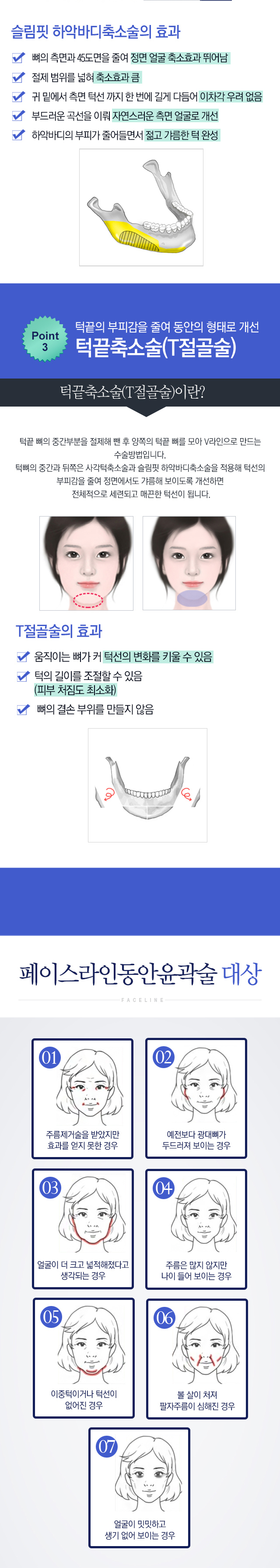 페이스라인 동안윤곽술