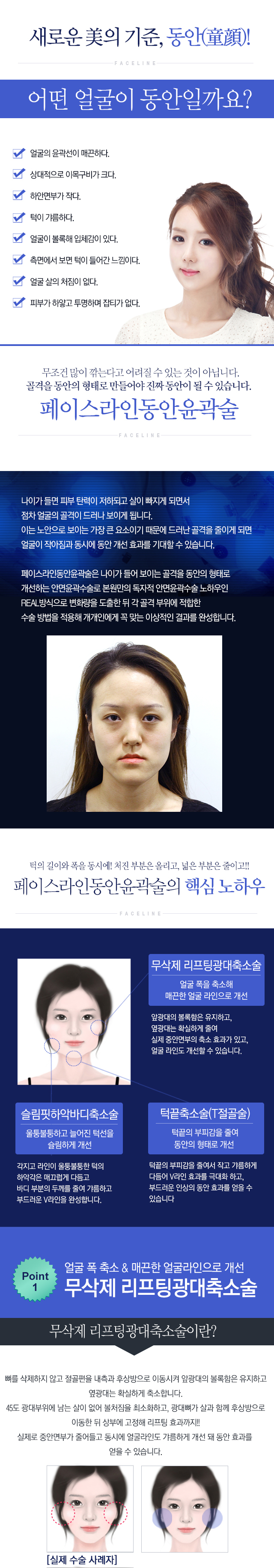 페이스라인 동안윤곽술