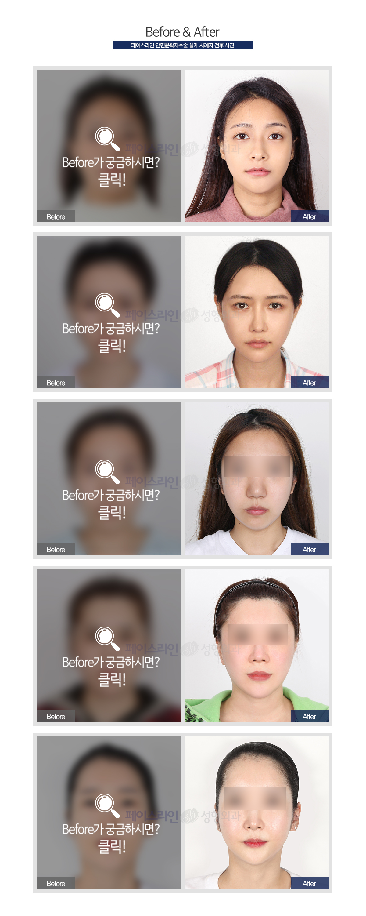 Before가 궁금하시면?클릭!