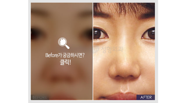 Before가 궁금하시면?클릭!