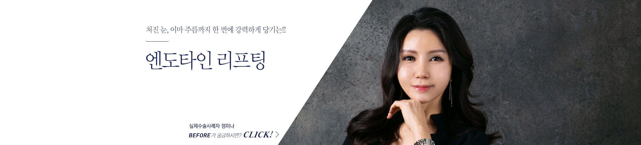 pc_엔도타인리프팅_상단2.jpg