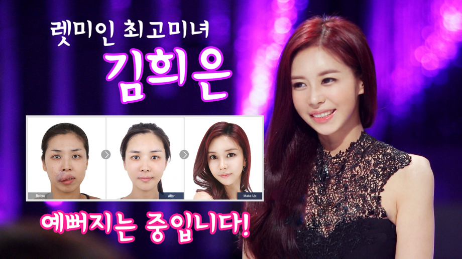 렛미인 절대미모 김희은 수술 후 노메이크업 쌩얼 공개! 쌩얼도 예쁜 양악수술 리얼모델후기