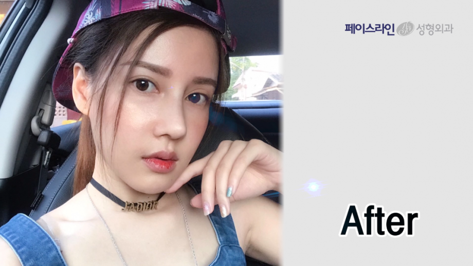 미미-페이스라인방문기