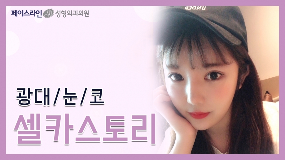 무삭제 리프팅 광대축소수술