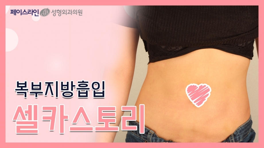 복부지방흡입