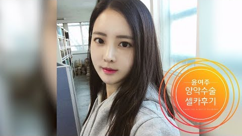 양악수술