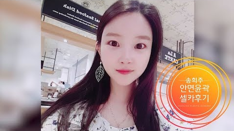 안면윤곽수술