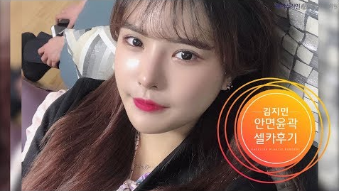 안면윤곽수술