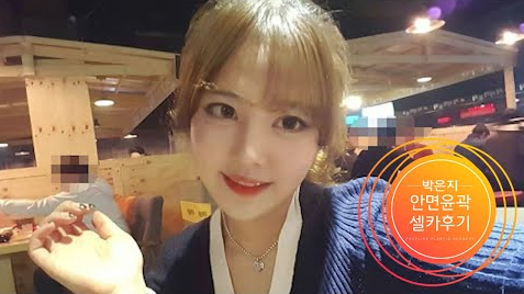 안면윤곽수술
