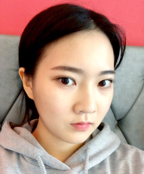 소이