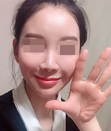 승아