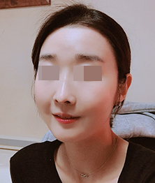 소진