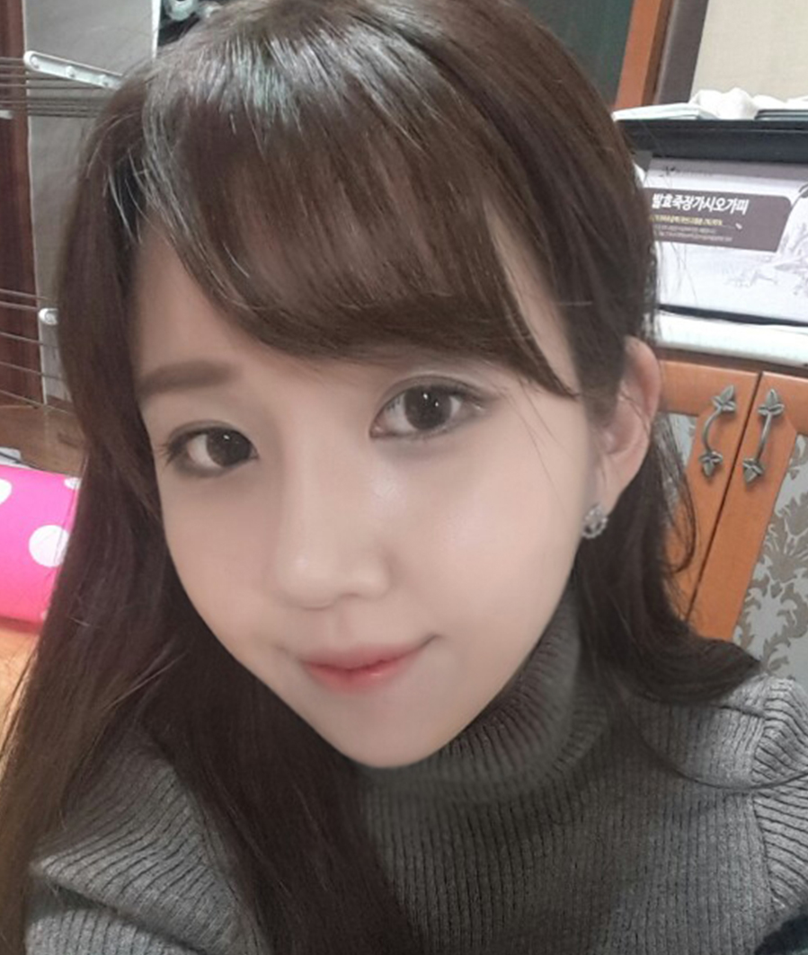 정희