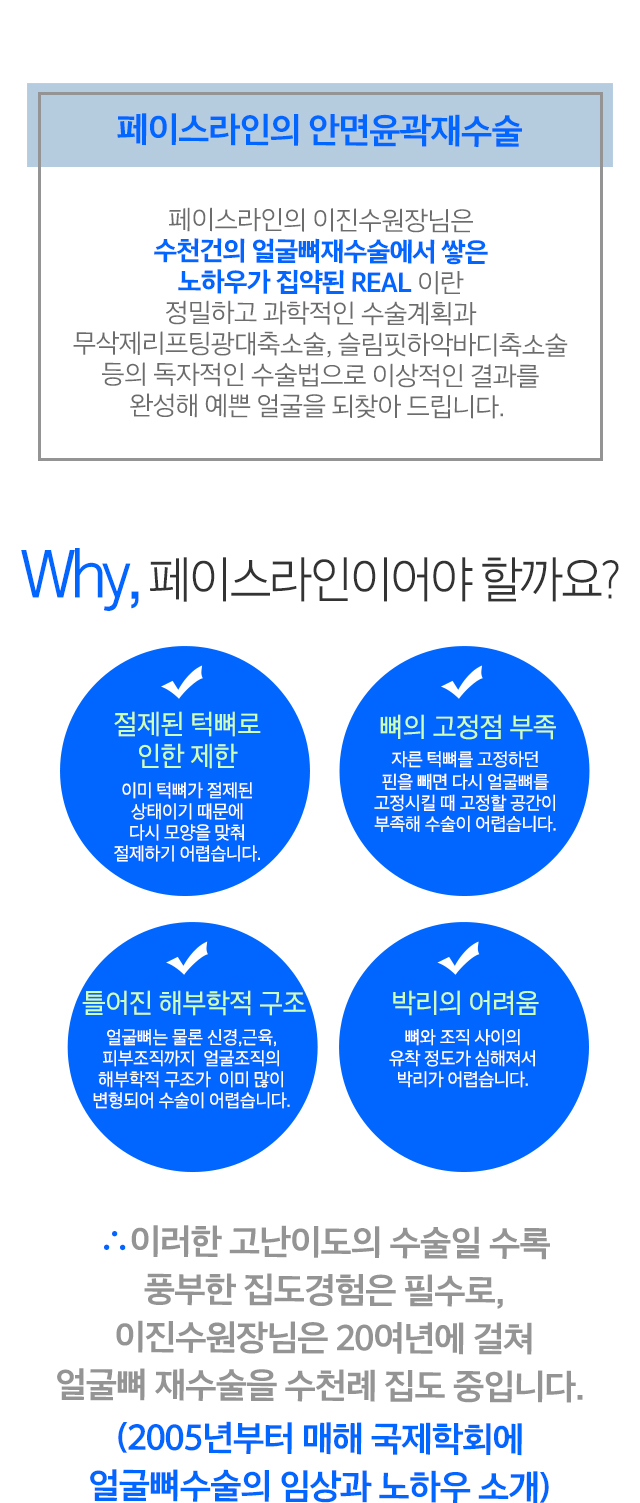 안면윤곽재수술