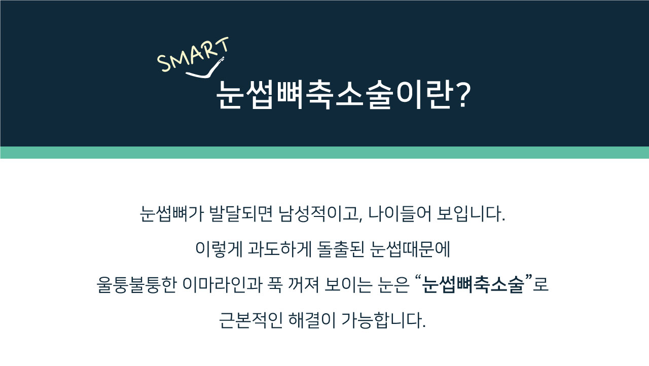 눈썹뼈출소술