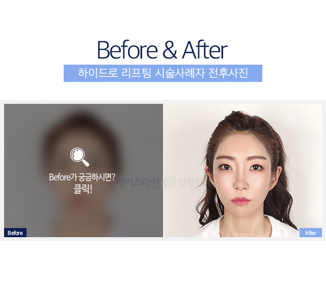 Before ñϽø?Ŭ!